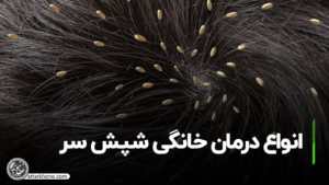 انواع درمان خانگی شپش سر