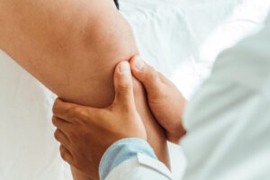 آب گرفتگی زانو