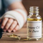 روغن کنجد برای سوختگی