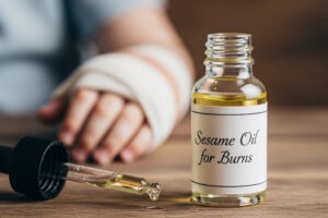 روغن کنجد برای سوختگی